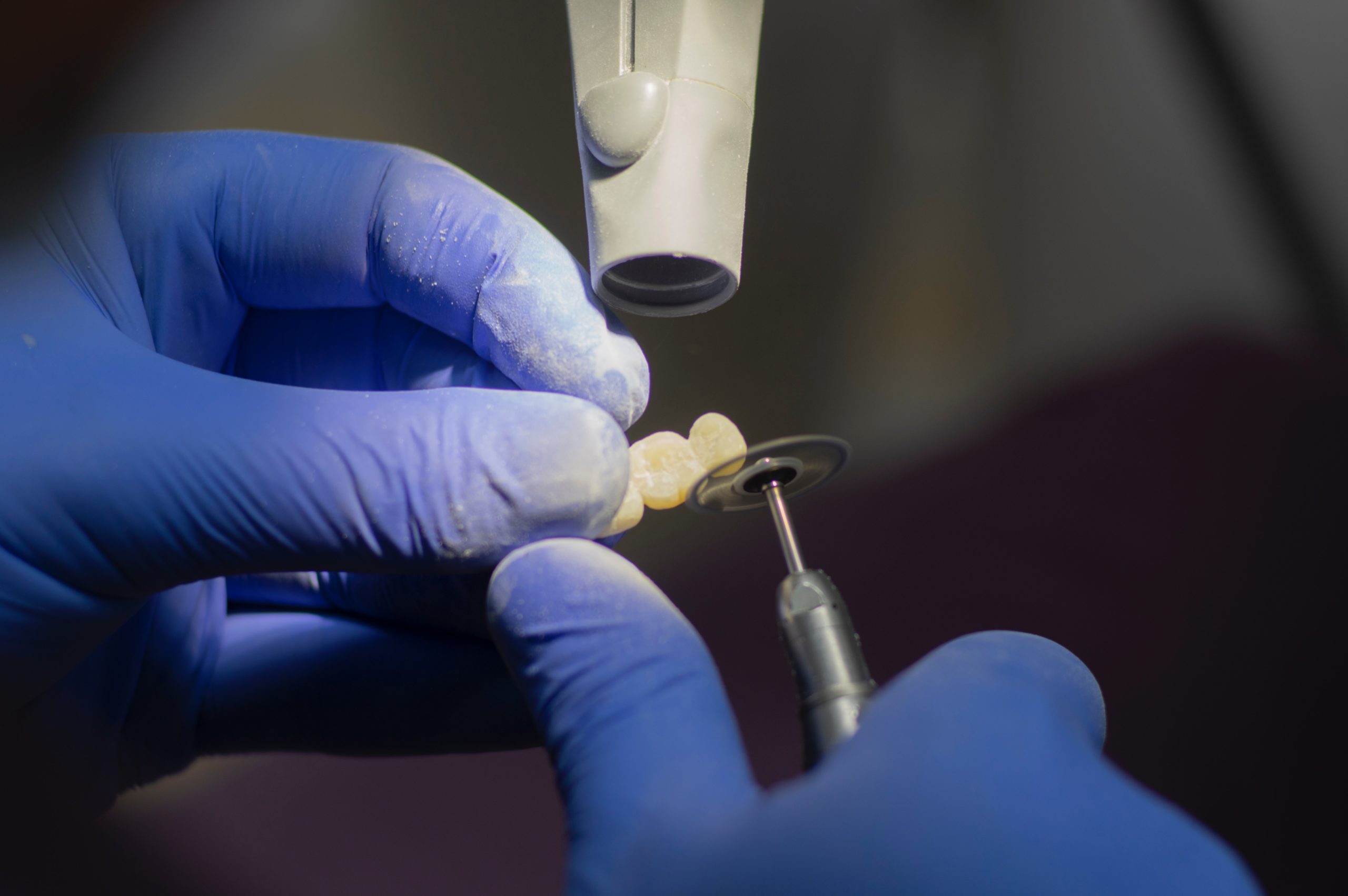 Implant Crowns vs. Dental Crowns