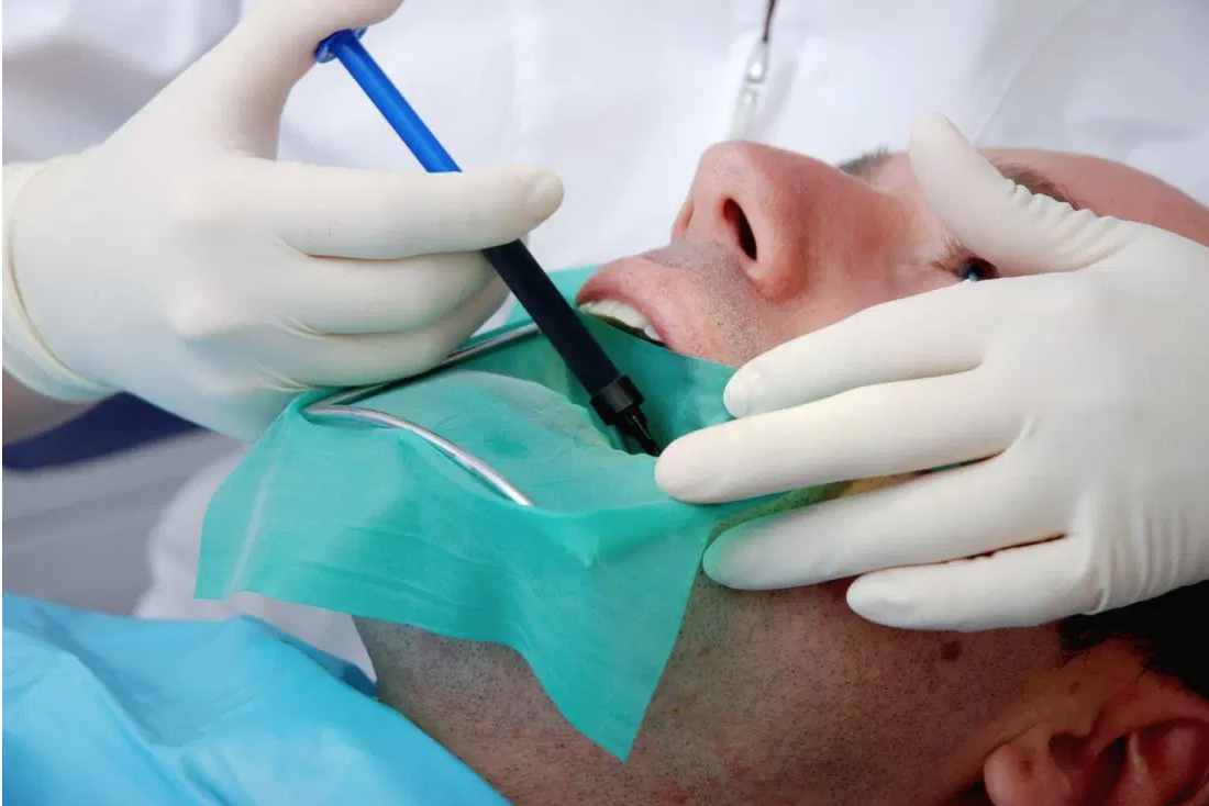 Root canal therapy is safe and effective