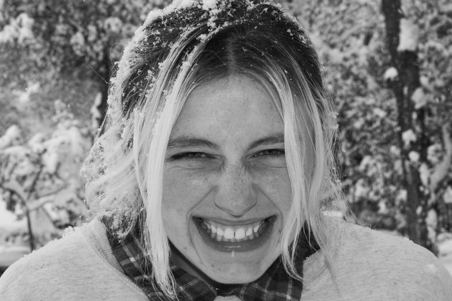 Frostbite: teeth sensitivity